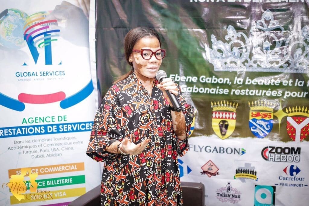 La jeune Gabonaise engagée Ornella Tonda s’est exprimée lors d’un entretien accordé le 15 mai 2026 sur son parcours marqué par le vitiligo