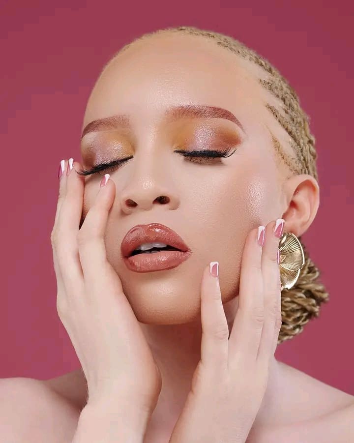 Albinos, mannequin et fière : Cycy Yombi impose sa lumière face aux préjugés