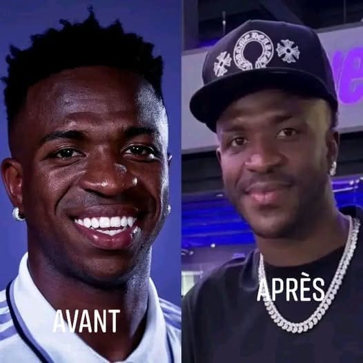 Sportifs et chirurgie esthétique, ces stars afro dont le physique a connu une métamorphose 