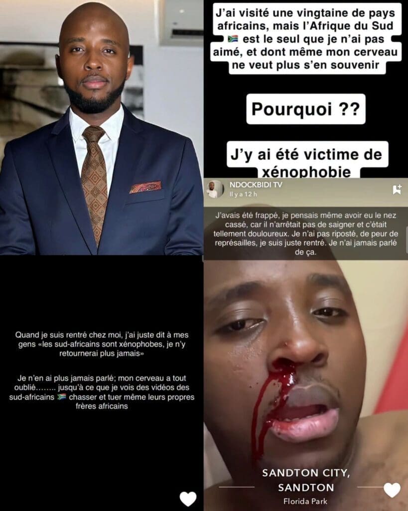Le chef cuisinier camerounais Ndock Bidi a choisi de raconter, pour la première fois en public, l'agression dont il dit avoir été victime, un épisode qu'il avait jusque-là gardé pour lui.